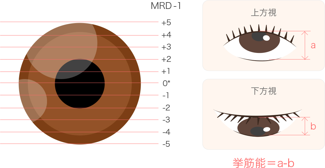 保険適用になる基準ってあるんですか